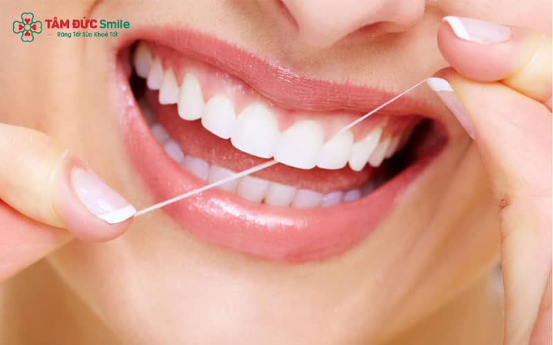Răng sứ Titan bị đen viền nướu sau thời gian dài sử dụng