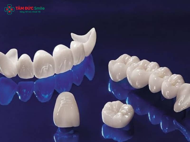 Răng sứ titan có bị đen không? Nguyên nhân, dấu hiệu và cách khắc phục hiệu quả