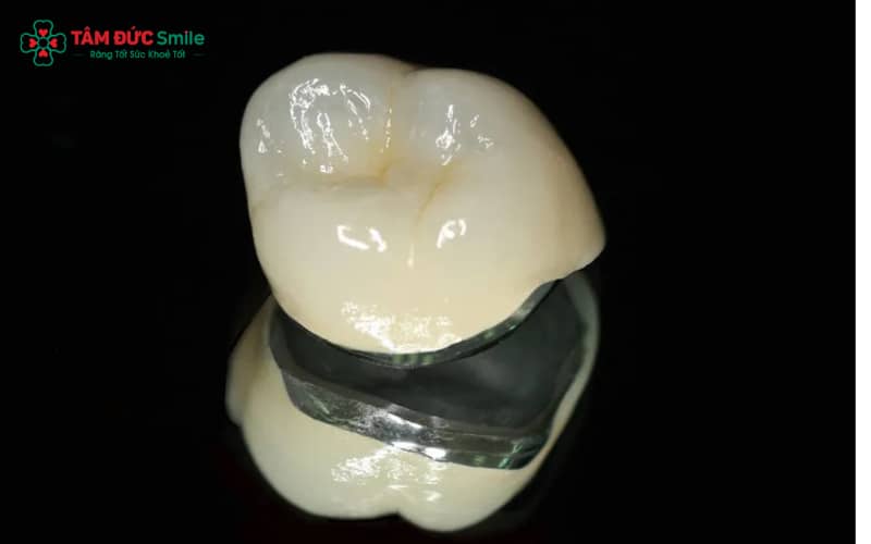 Cấu tạo răng sứ Titan với lõi kim loại và lớp sứ phủ ngoài
