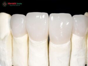 Răng sứ Zirconia thẩm mỹ tự nhiên, chắc khỏe