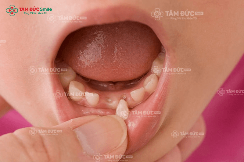 rang-vinh-vien-3