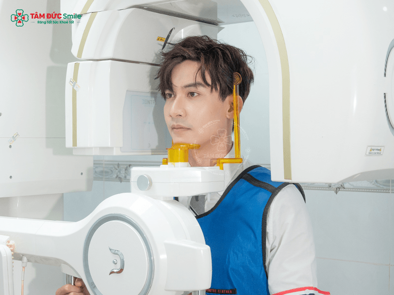 trong-rang-implant-all-on-4-3