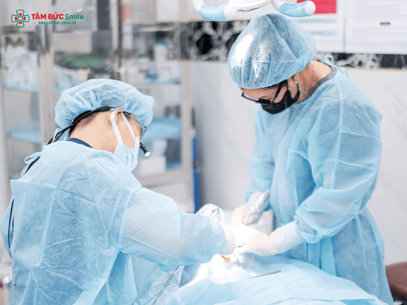 trong-rang-implant-all-on-4-4