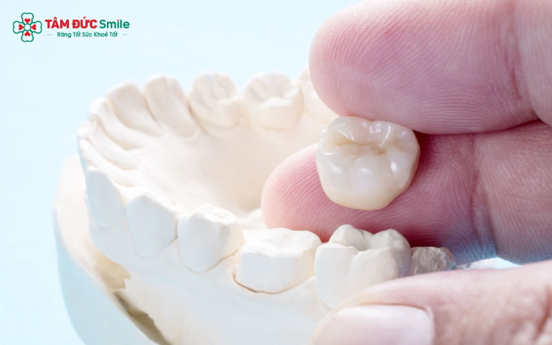 Răng sứ sinh học được chế tác từ vật liệu toàn sứ cao cấp, có khả năng tương thích sinh học tuyệt đối với cơ thể