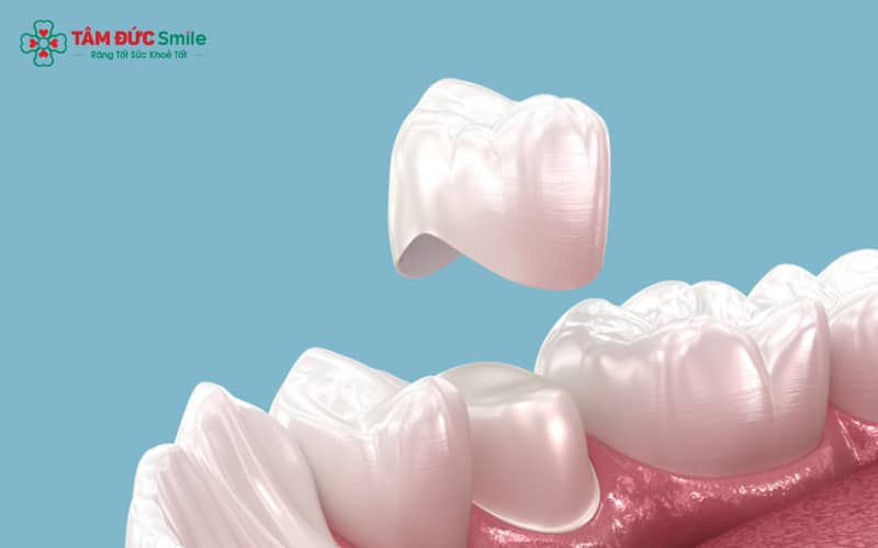 Chăm sóc đúng cách và tái khám định kỳ giúp duy trì độ bền và thẩm mỹ của răng sứ sinh học lâu dài.