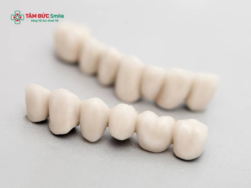 Bọc răng sứ vĩnh viễn có được không? Tuổi thọ, độ bền và cách chăm sóc