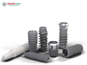 Cylinder Implant là gì? Cấu tạo, ưu nhược điểm và quy trình cấy ghép