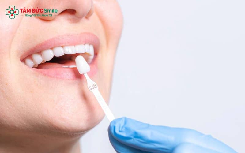 Chăm sóc răng sứ sau điều chỉnh: đánh răng nhẹ nhàng, dùng chỉ nha khoa, ăn uống hợp lý và tái khám định kỳ để duy trì độ bền và thẩm mỹ