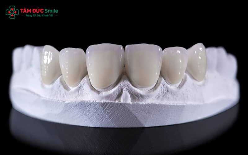 Labo nha khoa là nơi chế tác răng sứ, mão răng, phục hình cố định và tháo lắp, đảm bảo kết quả thẩm mỹ và chức năng ăn nhai