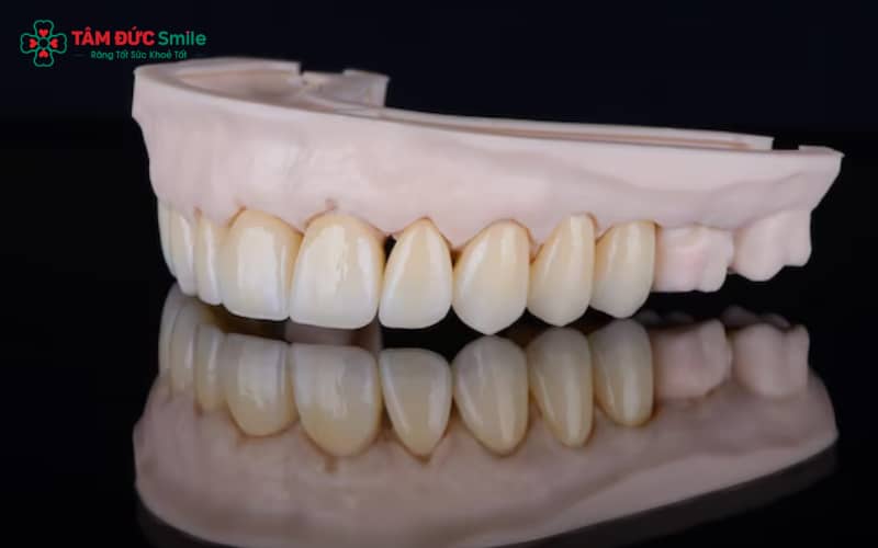 Labo hiện đại sử dụng công nghệ CAD/CAM 3D, máy in 3D và lò nung tự động, giúp răng sứ chính xác, thẩm mỹ