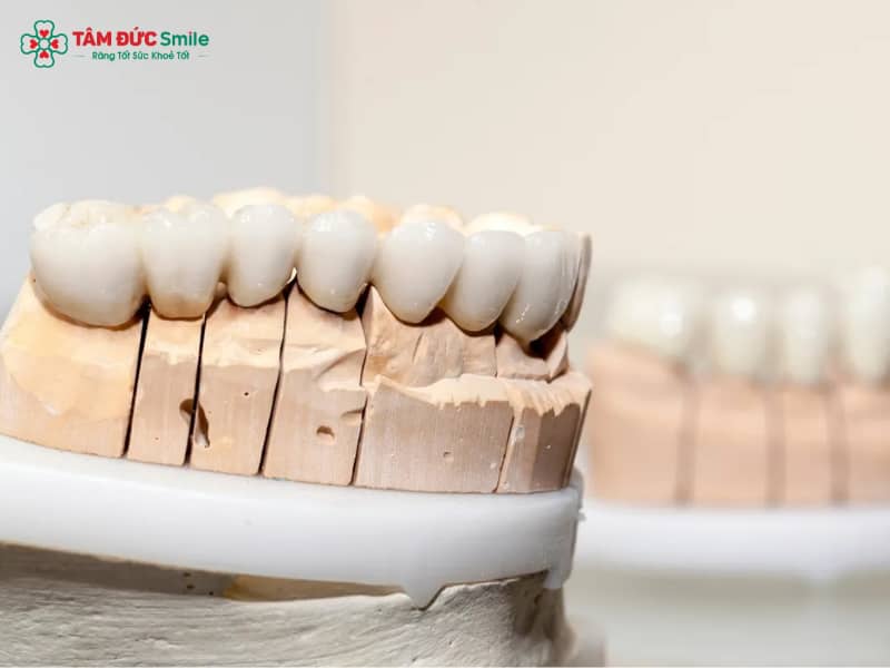 Labo nha khoa là gì? Quy trình, vai trò và công nghệ chế tác răng sứ hiện đại