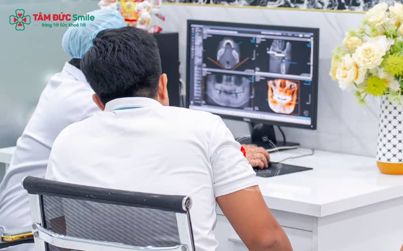 Hệ thống CT Cone Beam 3D hỗ trợ khảo sát cấu trúc xương hàm, dây thần kinh và xoang hàm trước khi cấy Implant.
