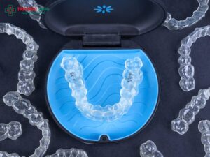 Nhược điểm của niềng răng Invisalign và cách khắc phục hiệu quả