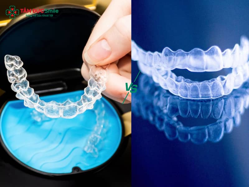 So sánh niềng răng 3D Clear và Invisalign: Công nghệ, chi phí, hiệu quả thực tế
