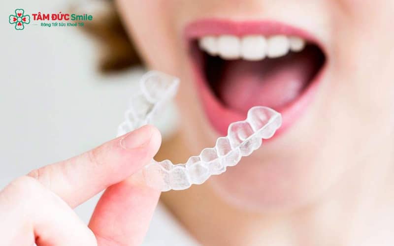 Bác sĩ sẽ cân nhắc kỹ để bảo tồn tối đa răng thật
