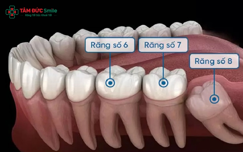 Răng cấm chỉ mọc một lần, không mọc lại nếu mất