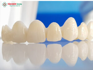 Răng sứ Cercon là gì? Ưu điểm, giá và độ bền tại Nha khoa Tâm Đức Smile
