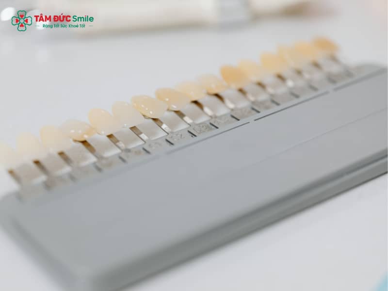 Răng sứ có bị mòn không? Nguyên nhân và cách khắc phục