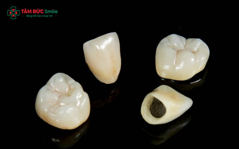 Răng sứ Crom Coban là dòng răng sứ kim loại với sườn hợp kim Co–Cr, có độ cứng và khả năng chịu lực cao