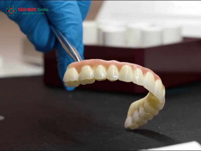 Răng sứ Crom Coban là gì? Cấu tạo, ưu nhược điểm và độ bền chi tiết