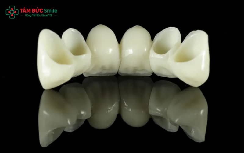 Răng sứ DDBio mang lại độ bền cao, thẩm mỹ tự nhiên và an toàn tuyệt đối cho nướu