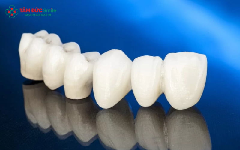 Chăm sóc đúng cách giúp răng sứ DDBio bền đẹp lâu dài và duy trì độ khít sát tối ưu
