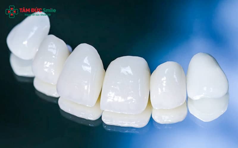 Răng sứ Lava của Mỹ – thương hiệu cao cấp đến từ tập đoàn 3M ESPE, nổi tiếng toàn cầu về vật liệu nha khoa