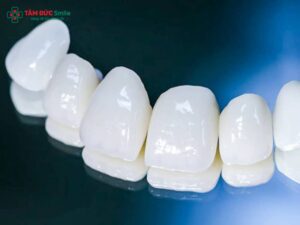 Răng sứ Lava của nước nào? Xuất xứ và ưu điểm nổi bật