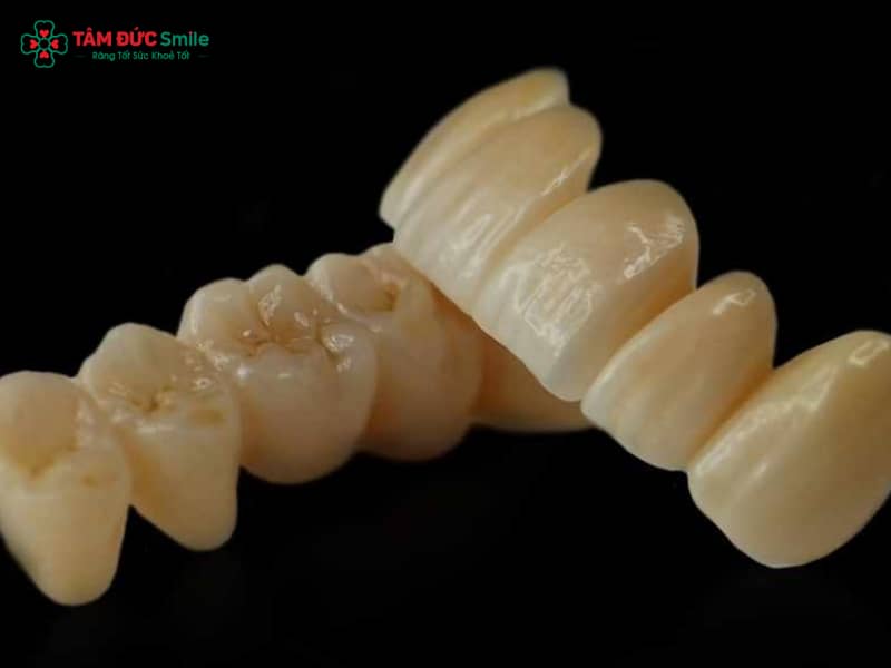 Răng sứ Nacera Zirconia Đức – Dòng răng toàn sứ cao cấp, bền đẹp tự nhiên