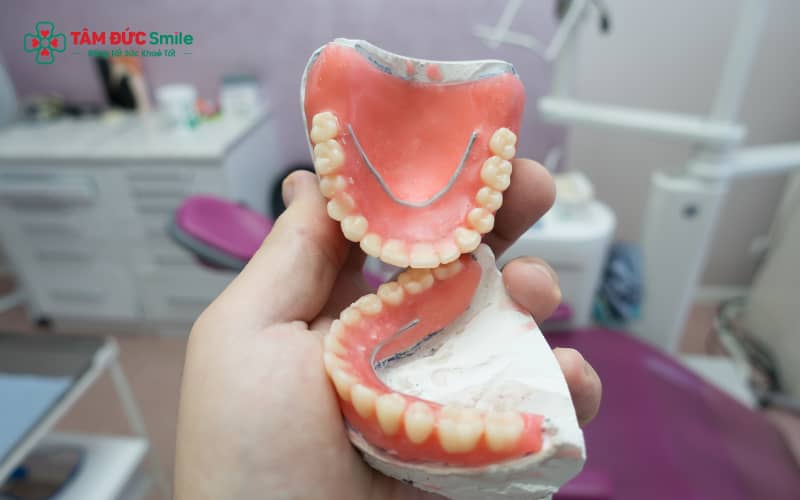 Vệ sinh đúng cách bằng bàn chải mềm, dung dịch chuyên dụng và bảo quản đúng cách giúp răng sứ tháo lắp bền đẹp lâu dài