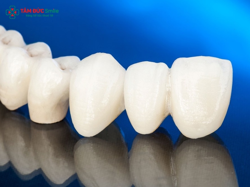 Răng sứ Zirconia Hàn Quốc là gì? Ưu điểm, cấu tạo và tuổi thọ bền lâu
