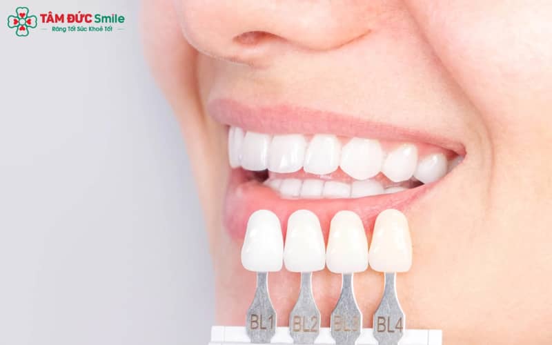 Sau khi bọc răng sứ nên làm gì - Vệ sinh răng sứ đúng cách, uống nhiều nước và duy trì thói quen buổi tối giúp hàm răng nhanh thích nghi