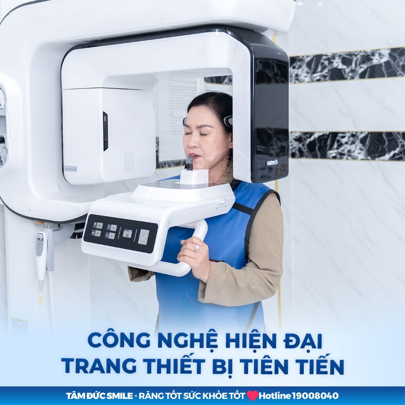 trong-rang-implant-tra-gop-4
