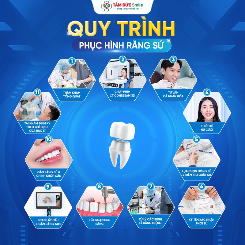 Quy trình bọc răng sứ tại Nha khoa Tâm Đức Smile gồm thăm khám, chuẩn bị cùi răng, lấy dấu hoặc scan, chế tác mão sứ, thử răng, kiểm tra khớp cắn và gắn cố định.