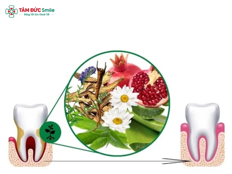 Lá lấu chữa sâu răng có hiệu quả không? Cách dùng, lợi ích và lưu ý