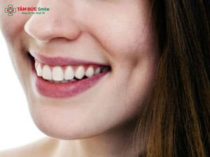 Má lúm răng khểnh có đẹp không? Ý nghĩa, thẩm mỹ răng khểnh duyên tự nhiên