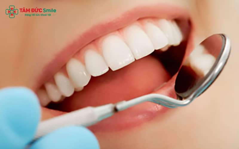 Nha khoa Tâm Đức Smile cung cấp nhiều dịch vụ thẩm mỹ răng, đáp ứng từng tình trạng và nhu cầu cải thiện nụ cười.