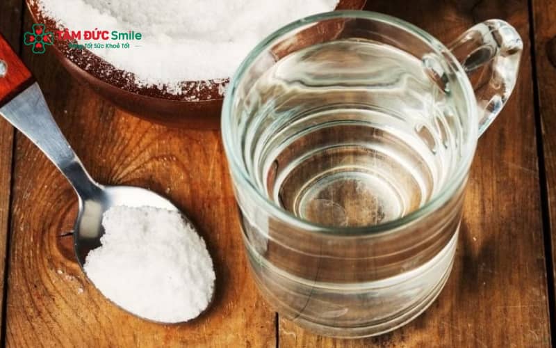 Thời điểm súc miệng nước muối sau nhổ răng khôn cần tuân thủ đúng hướng dẫn để tránh bung cục máu đông và viêm ổ răng.