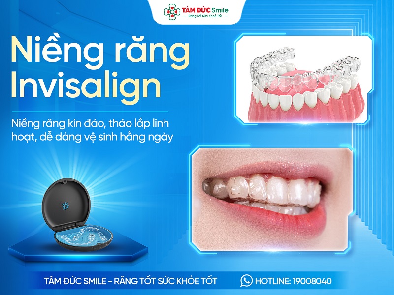 Niềng răng invisalign là gì? Giá, Ưu điểm và Quy trình thực hiện