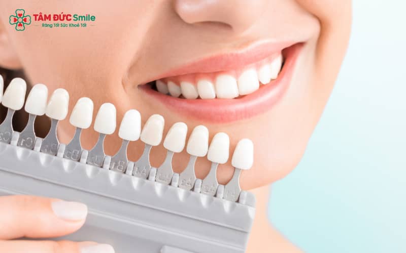 Biến chứng dán sứ veneer thường xuất phát từ việc lựa chọn sai đối tượng, vật liệu kém chất lượng hoặc bác sĩ thiếu kinh nghiệm chuyên sâu