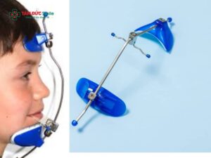 Facemask chỉnh nha là gì? Giải pháp kéo hàm trên hiệu quả cho trẻ móm