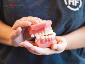Khí cụ chỉnh nha headgear: Tác dụng, cách đeo và trường hợp nên sử dụng