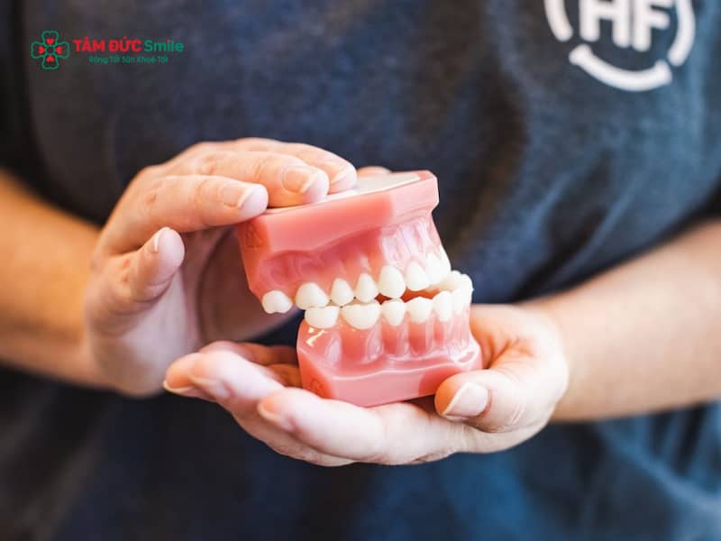 Khí cụ chỉnh nha headgear: Tác dụng, cách đeo và trường hợp nên sử dụng