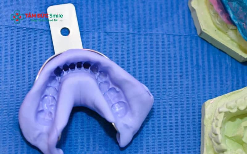 ấy dấu răng là bước quan trọng trong nha khoa nhằm ghi nhận chính xác hình dạng răng, nướu và khớp cắn