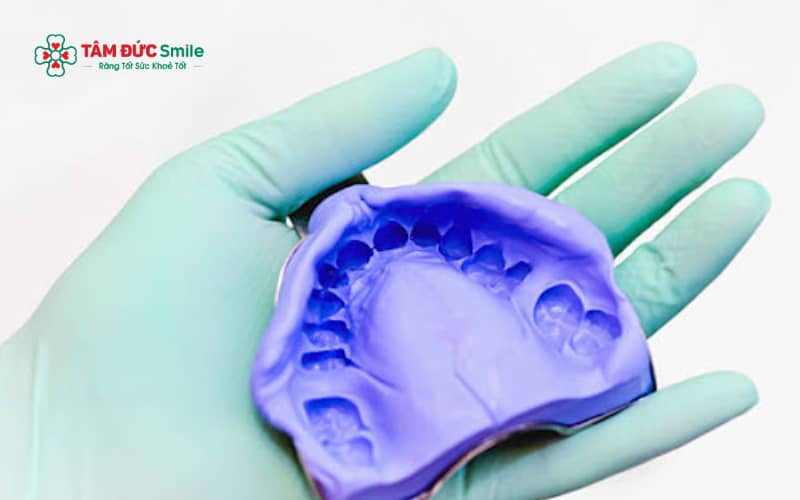 Lấy dấu răng được chỉ định trong nhiều trường hợp như bọc răng sứ, trồng răng Implant, chỉnh nha – niềng răng và các thủ thuật phục hình khác