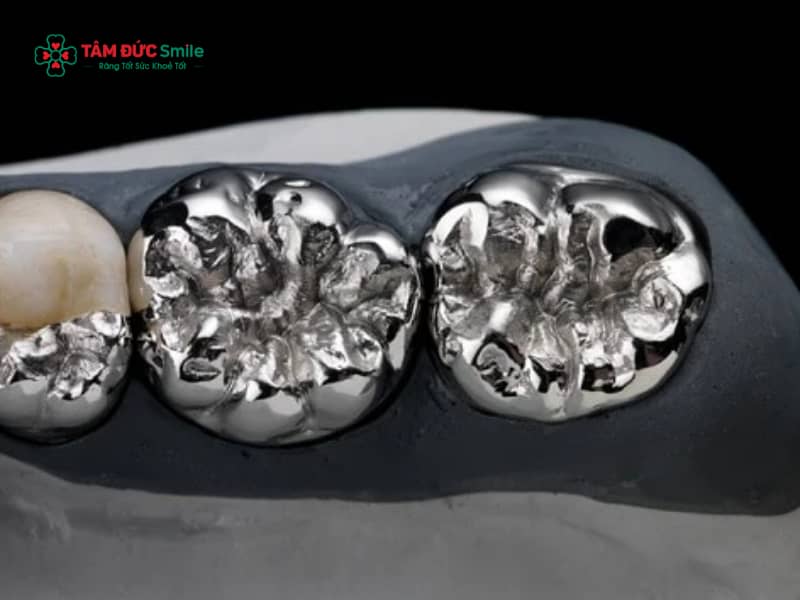 Răng sứ chrome cobalt là gì? Ưu nhược điểm và lưu ý chăm sóc sau khi bọc răng sứ chrome cobalt