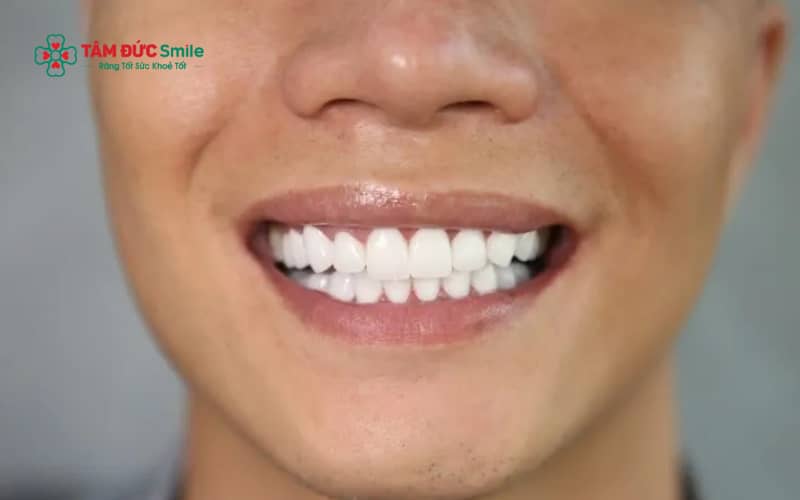 Xem tướng răng đàn ông là cách quan sát hình dáng, màu sắc và sự sắp xếp của răng để luận đoán tính cách, vận mệnh và đường công danh theo nhân tướng học