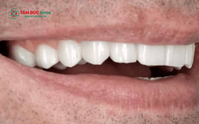 Theo quan niệm nhân tướng học, tướng răng đàn ông có thể phản ánh phần nào tính cách, khả năng giao tiếp