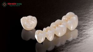 Công nghệ CAD/CAM giúp mão sứ zirconia đạt độ chính xác gần như tuyệt đối.