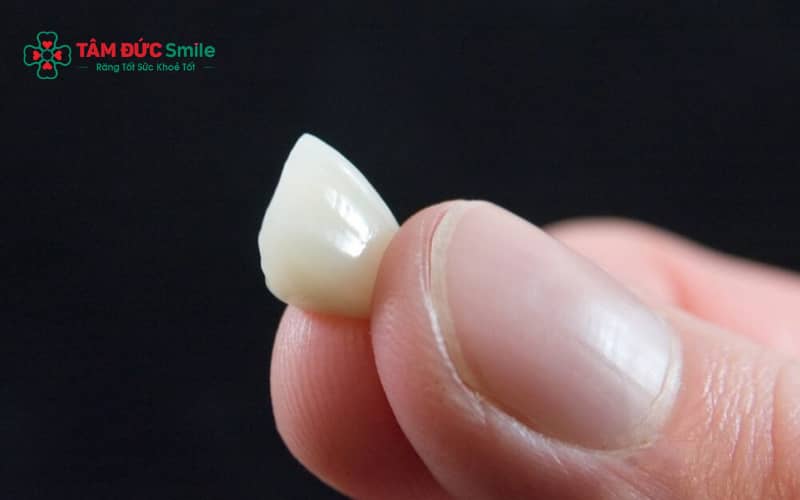 Nhiều yếu tố như keo dán, kỹ thuật phục hình hoặc thói quen ăn nhai có thể khiến răng sứ bị rớt.